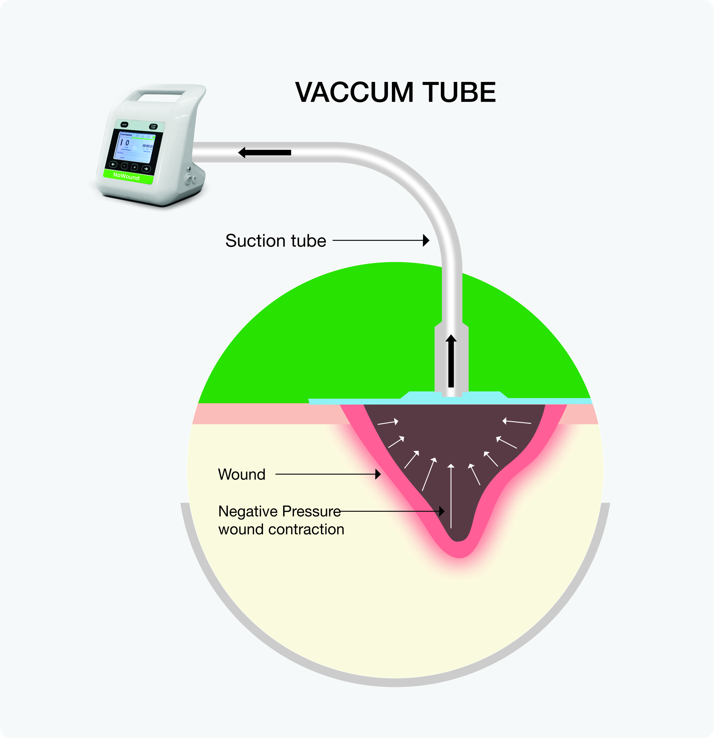 following mechanisms